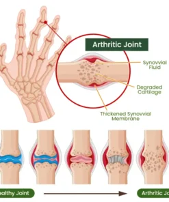 Adfire® Bee Venom Bone & Joint Revive Spray