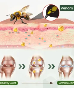 Adfire® Bee Venom Bone & Joint Revive Spray